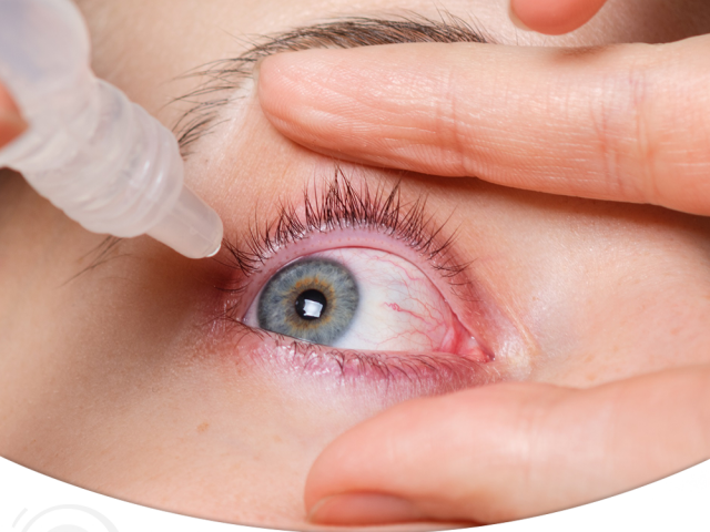 Síndrome do Olho Seco: Sintomas mais frequentes - D'Olhos Hospital Dia